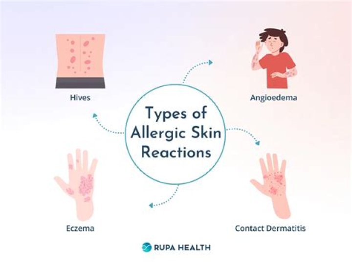 Why am I allergic to my new house?