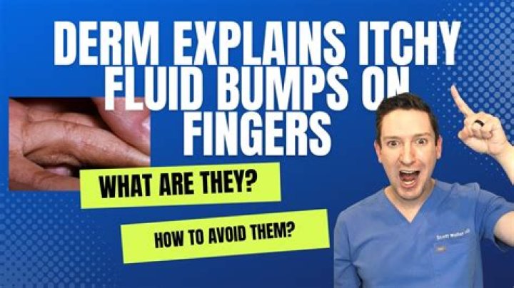 Why am I getting little bumps on my fingers?
