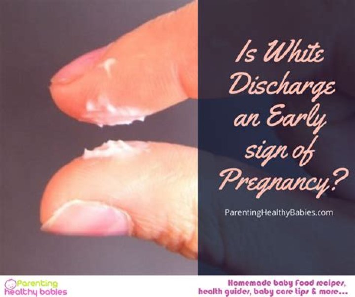 Why am I having white discharge and no period and not pregnant?