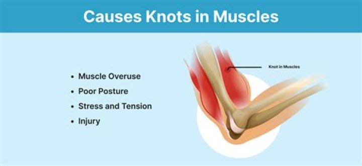 Why do I get muscle knots in my legs?