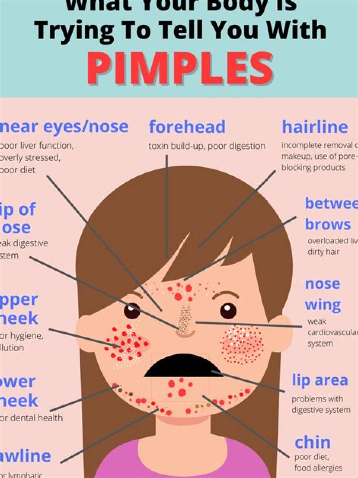 Why do I get pimples between my eyebrows?