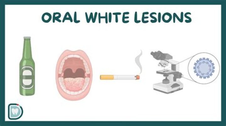 Why do I have a white wound in my mouth?