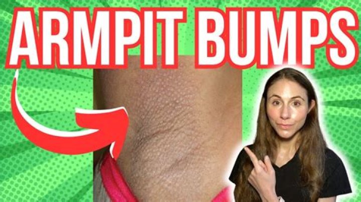 Why do I have bumps in my armpit?