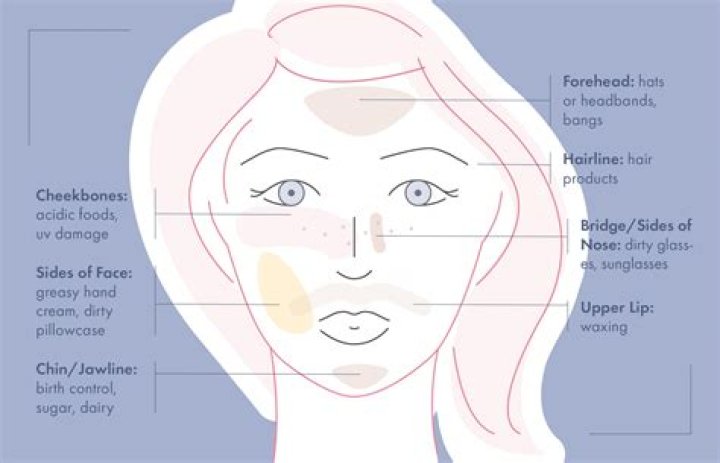 Why do I have little bumps around my nose and mouth?