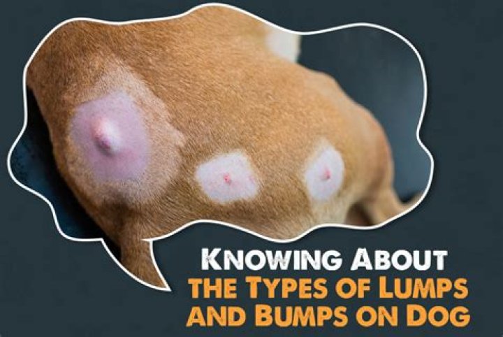 Why do I have lumps throughout my body?