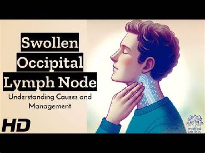 Why do my lymph nodes swell when I eat?