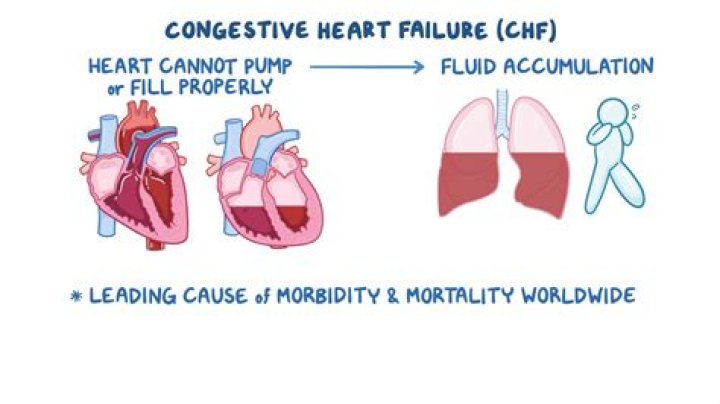 Why does CHF cause Diaphoresis?