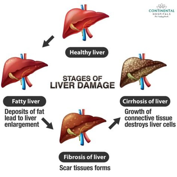 Why does liver disease cause asterixis?