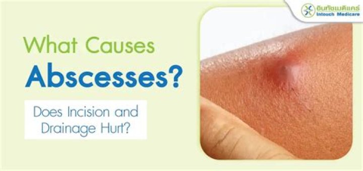 Why does my incision scar hurt?