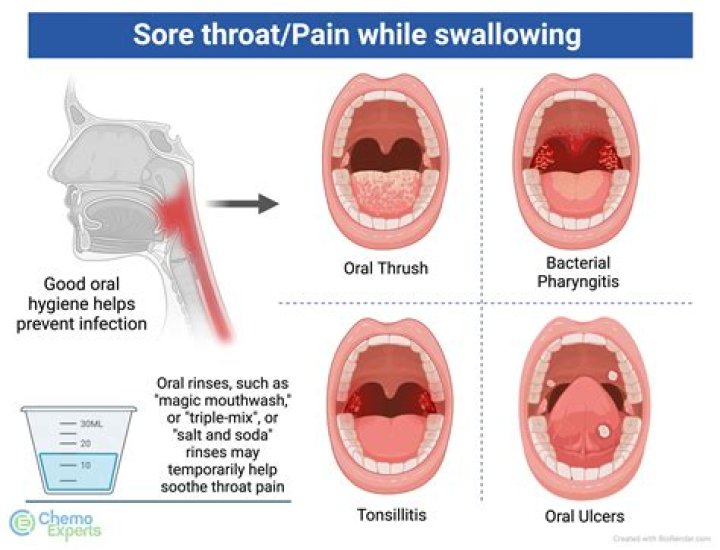 Why does my throat make a burping noise when I yawn?