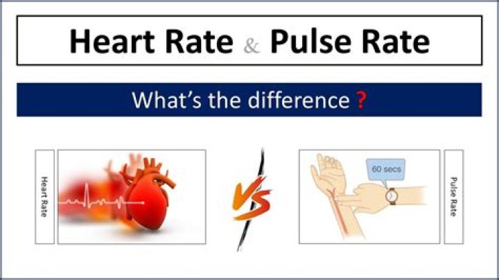 Why is ADT Pulse not working?