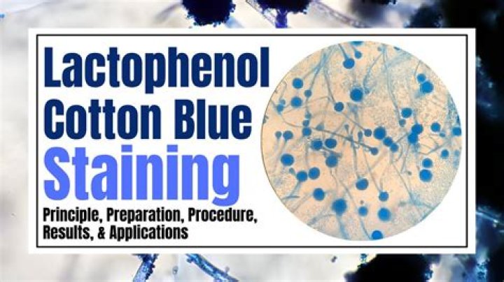 Why is fungi stained with Lactophenol cotton blue?