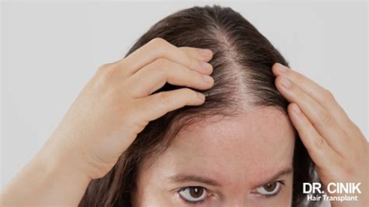Why is my hair thinning at 46?