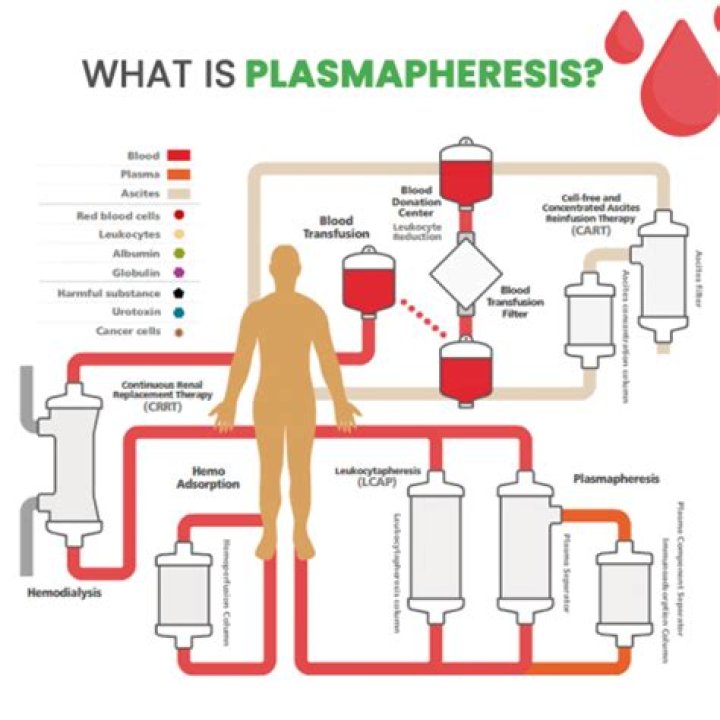 Why is plasmapheresis done for Guillain-Barre?