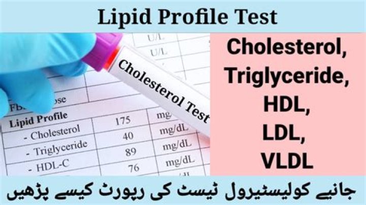 Why lipid profile test is done in fasting?