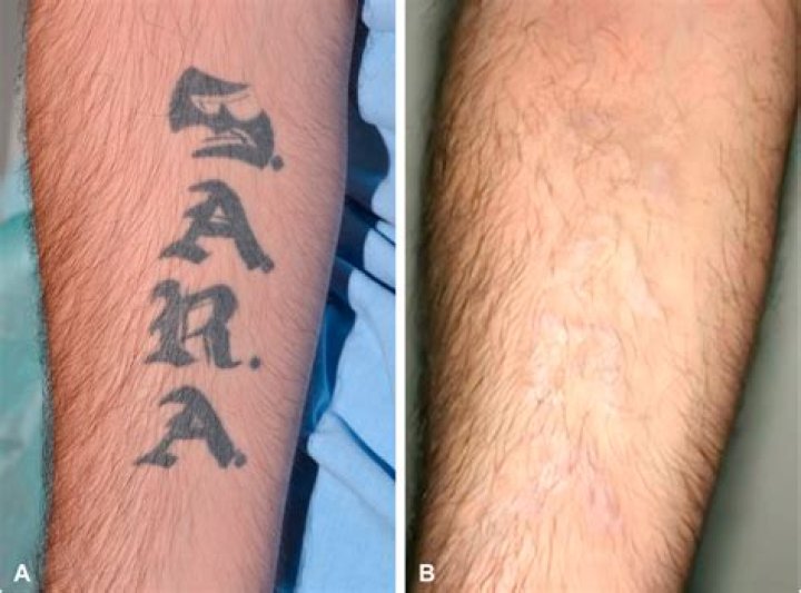 Will a wrist tattoo affect my future career?